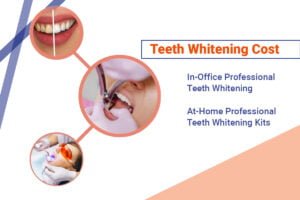 teeth whitening cost in kolkata