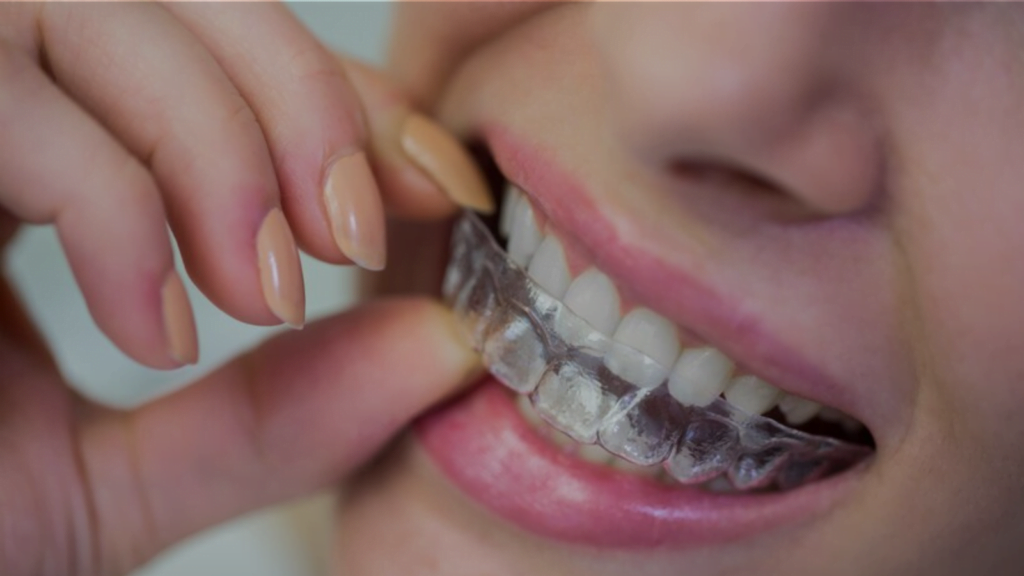 Best Dental Treatments for Overbite Correction at Dr Anuradha Bose Dental Clinic