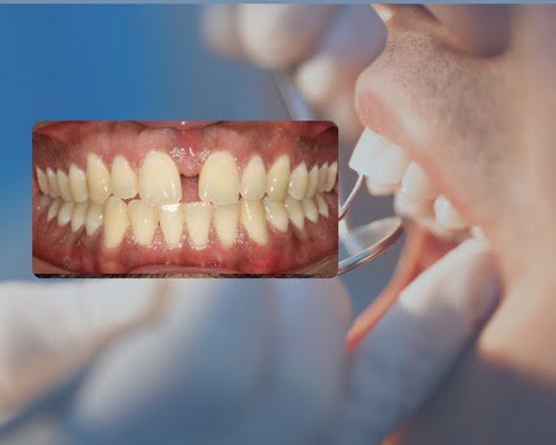 WhatsApp Image 2023-12-08 at 6.12.38 PM (1) WhatsApp Image 2023-12-08 at 6.12.38 PM (1)