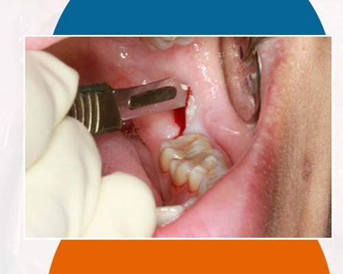 WhatsApp Image 2023-12-12 at 5.57.01 PM (1) WhatsApp Image 2023-12-12 at 5.57.01 PM (1)