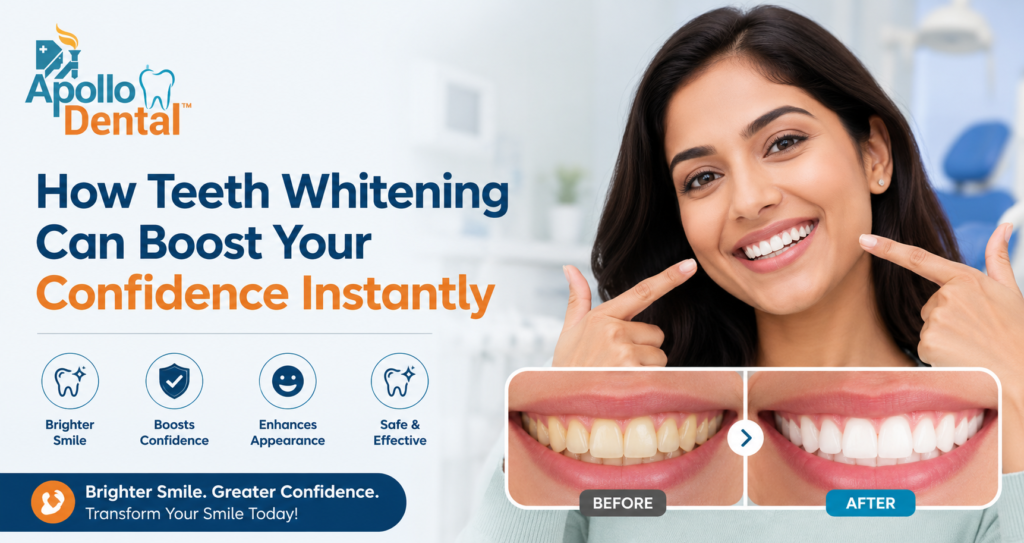 How Teeth Whitening Can Boost Your Confidence Instantly