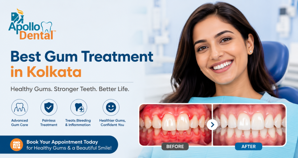 Best Gum Treatment in Kolkata